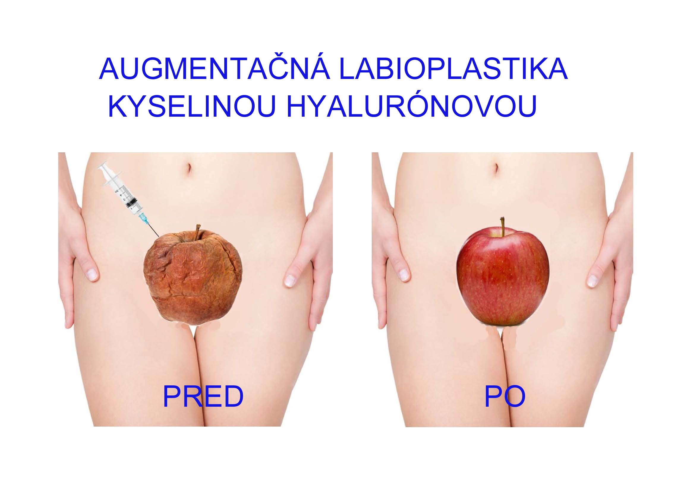Oholený vagína obrázok