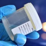 spermiogram vyšetrenie